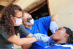 Tooth Extraction